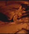 Man Does Naked Snow Angel